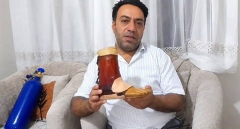 Protez bacak alamayan engelli yurttaş, koli bandıyla tamir ediyor